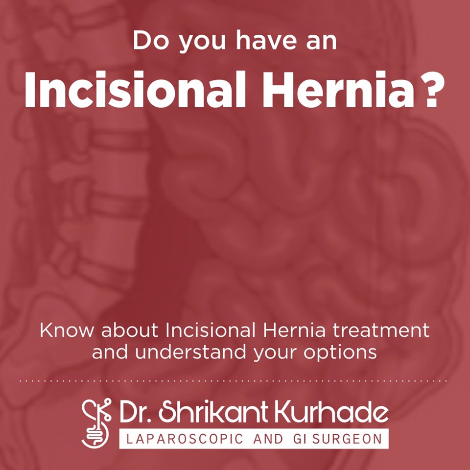 Incisional hernia