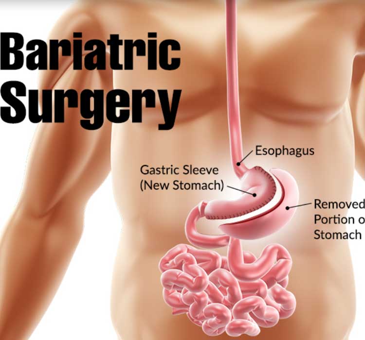 Bariatric Surgeon in Pune | Dr Shrikant Kurhade