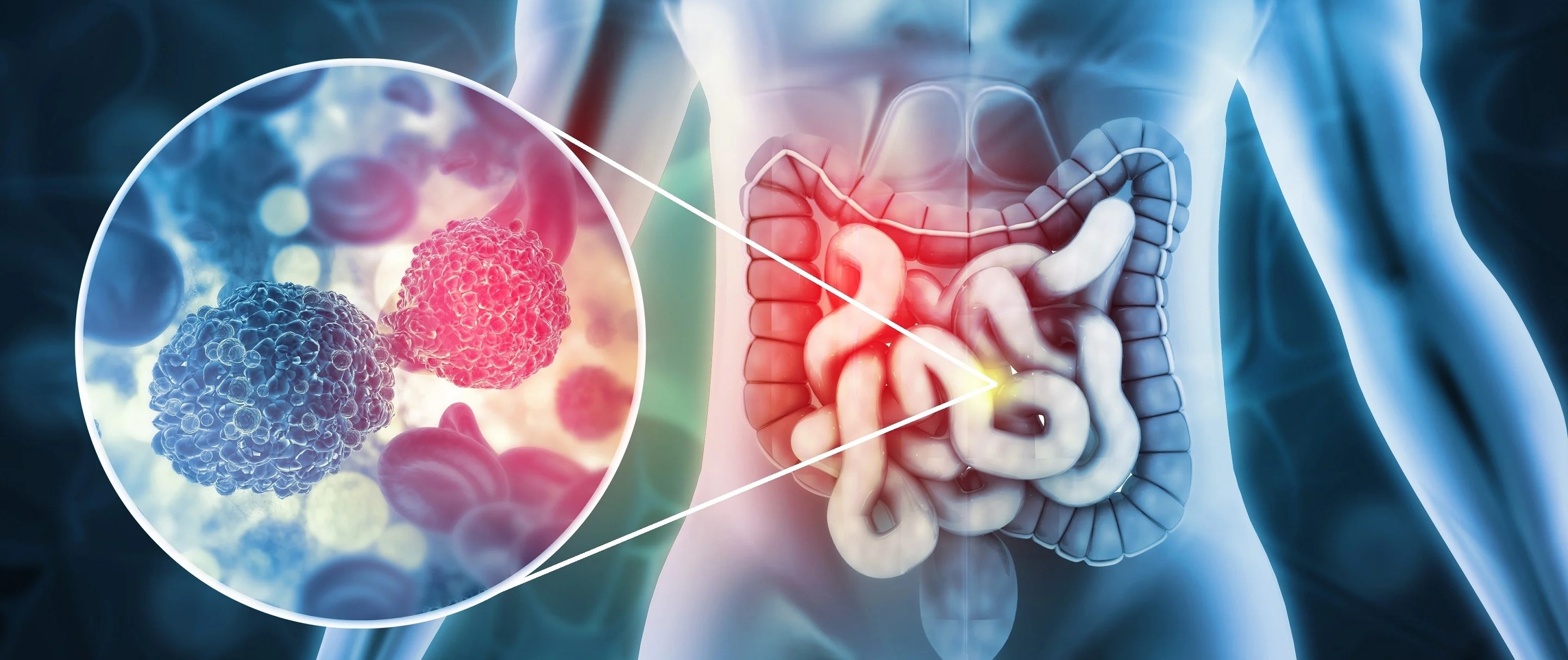 Laparoscopic Gastrointestinal Surgery