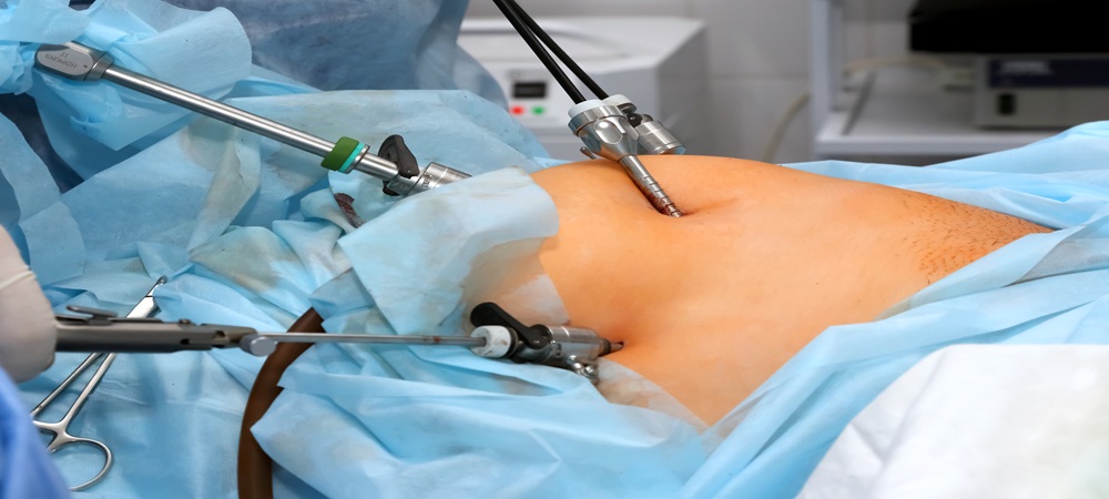 Robotic Bariatric Surgery