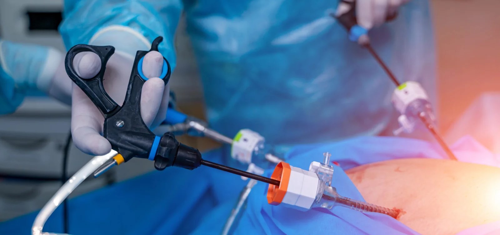 Robotic Fundoplication Surgery