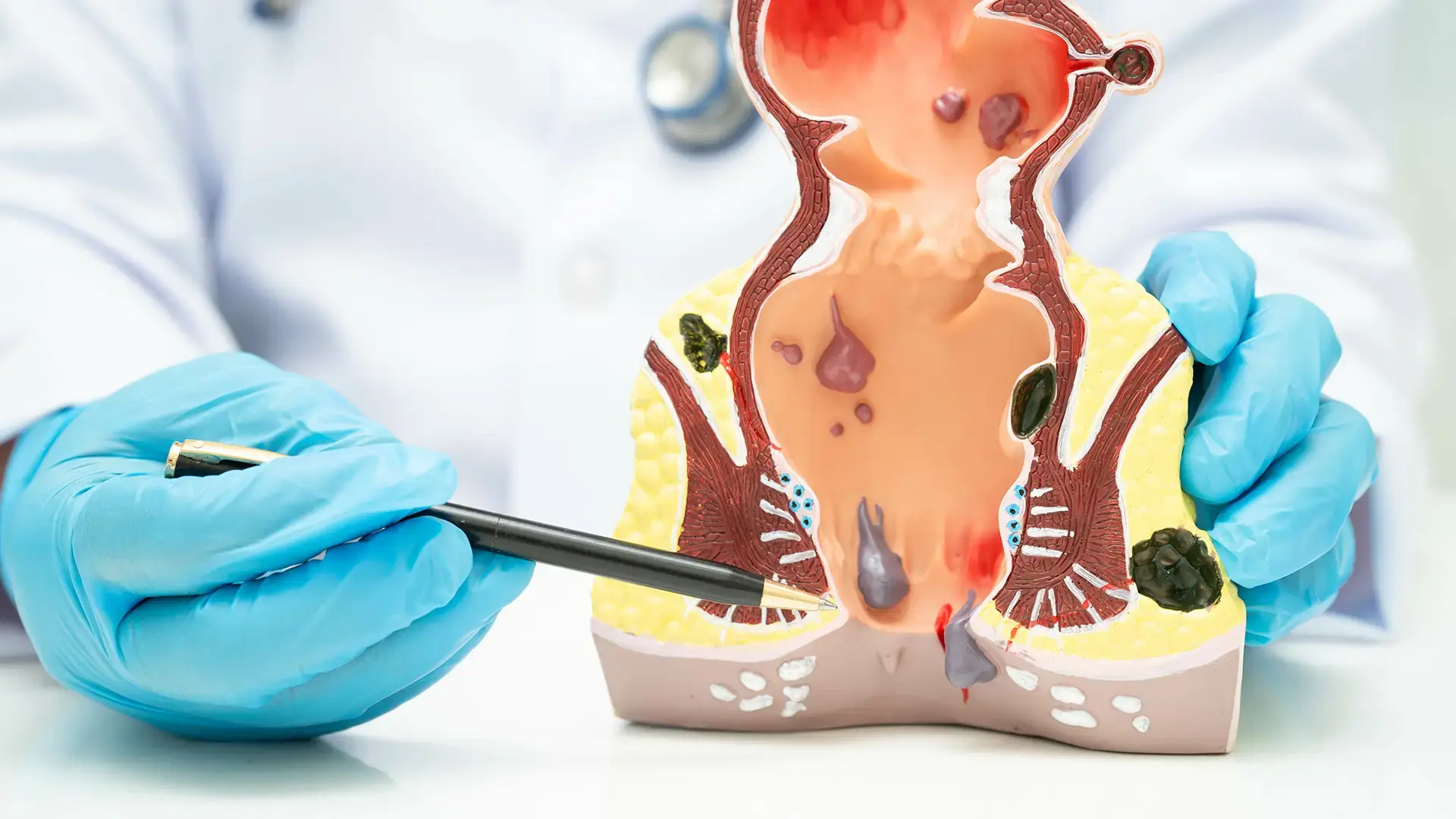 Best Piles Doctor in Pune - Dr Shrikant Surgeon