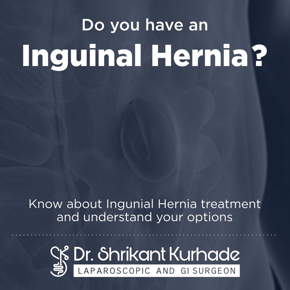 ingunal-hernia