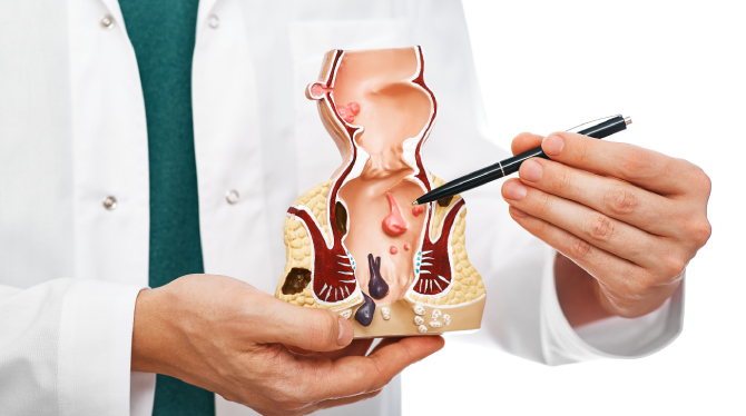 Pilonidal Sinus Surgery Treatment in India - Dr Shrikant Surgeon